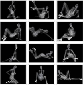 series of x-ray photos of a woman in various poses, similar to sexy ones they might make in a photo shoot